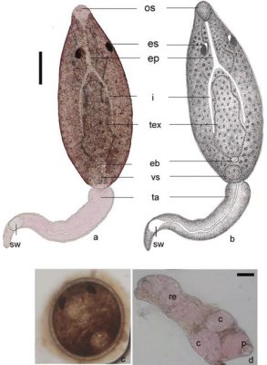  Gastrothylax crumenifer: A Fluke That Thrives in the Ruminant Stomach and Indulges in Exquisite Mucus Feasts!